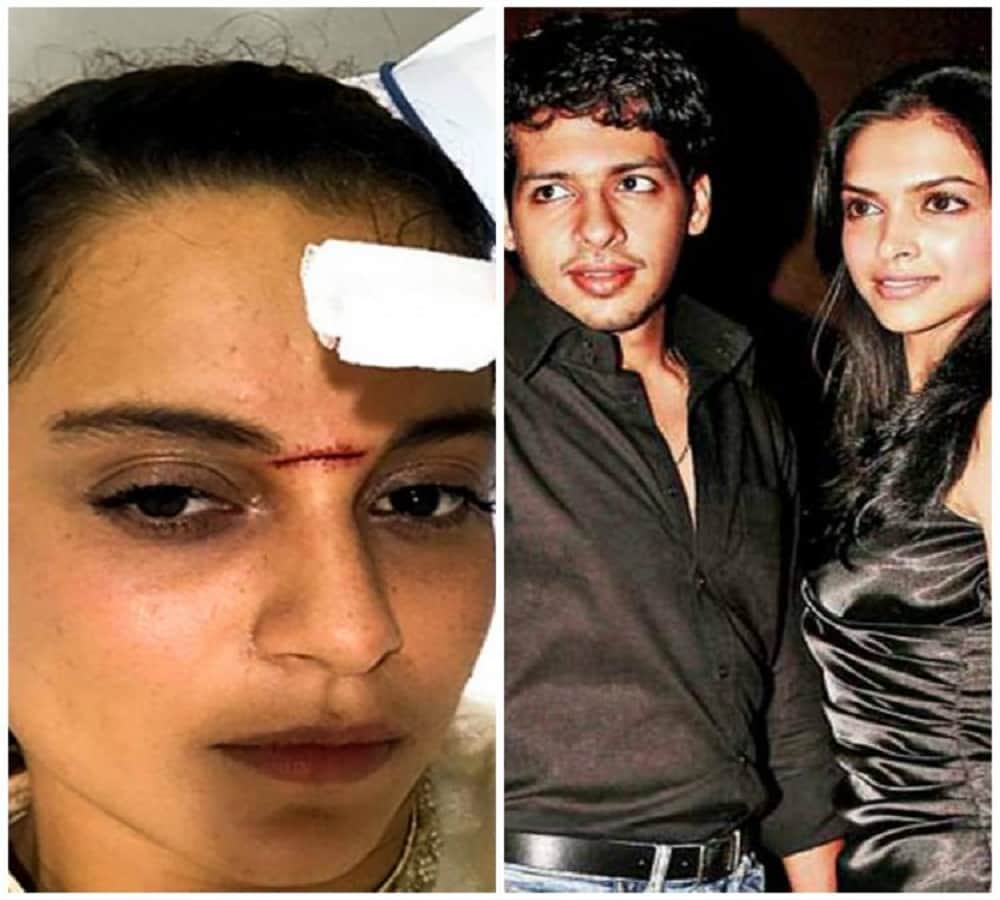 kangana ranaut injured while shooting for the film manikarnika 