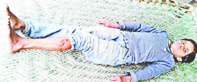 Dogs injured children and villagers