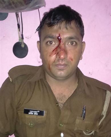 Police officers attacked in Chandaus, injured soldiers
