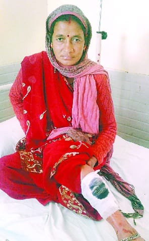woman fought for life with leopard