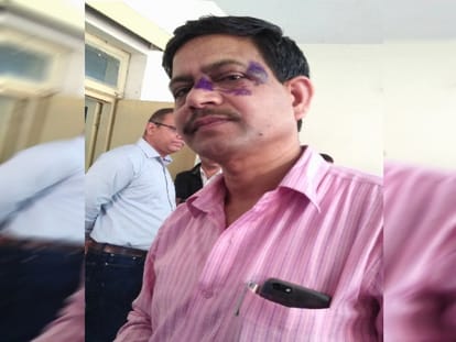 villagers beaten Deputy Commissioner in roorkee