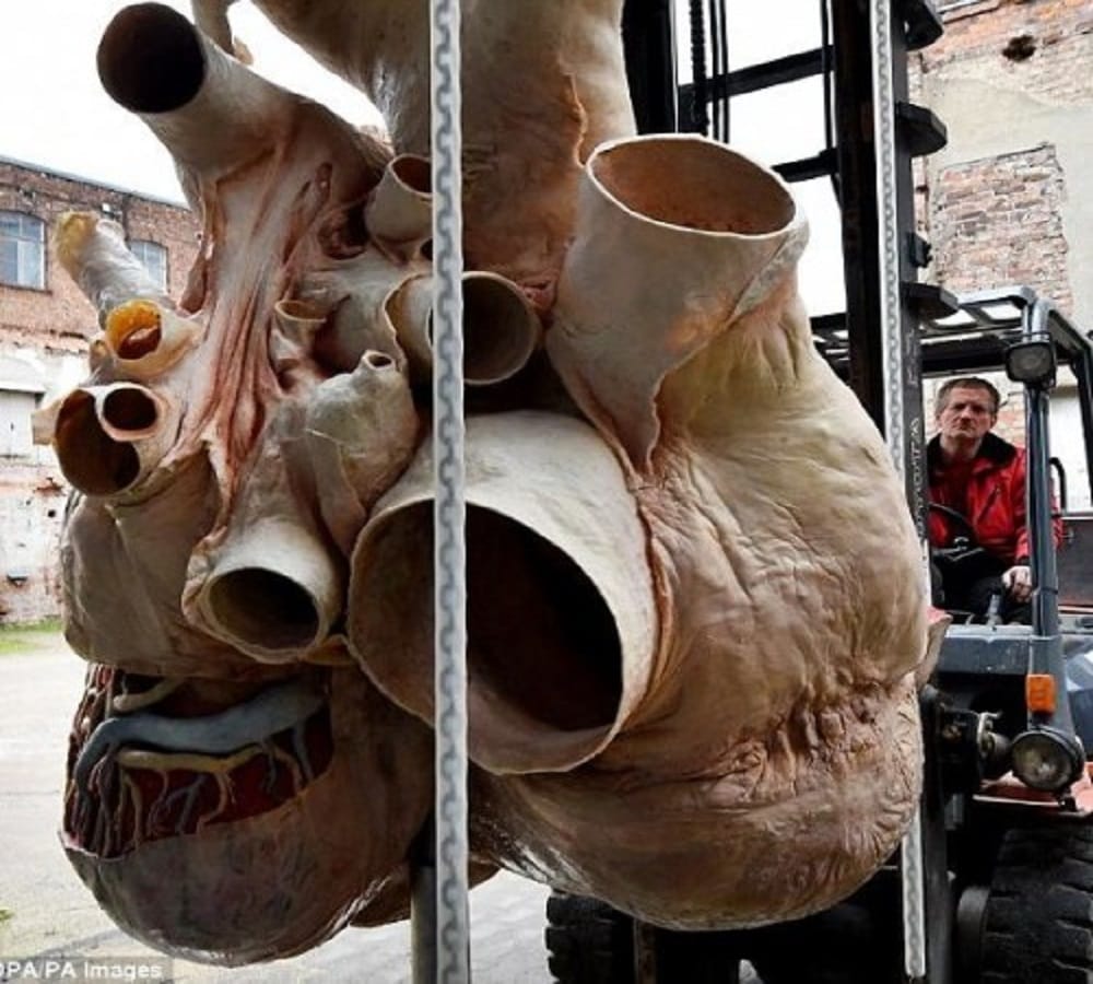 This is the worlds heaviest heart weight is 262 kg