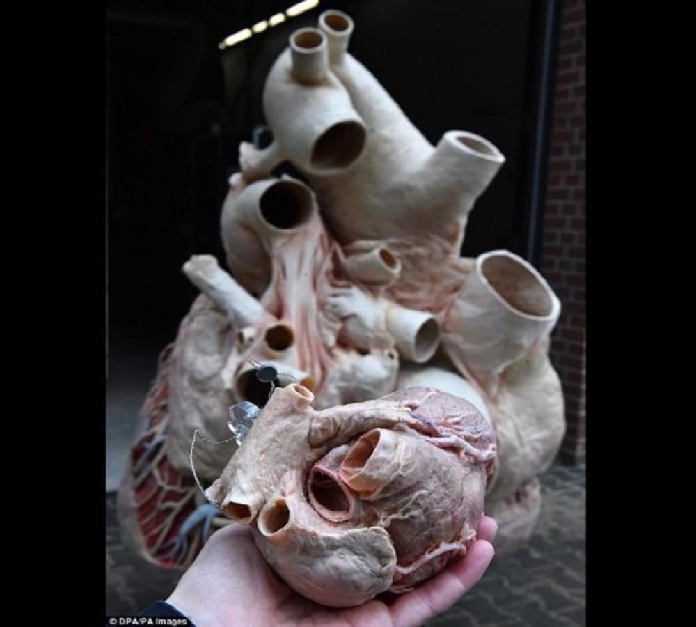 This is the worlds heaviest heart weight is 262 kg