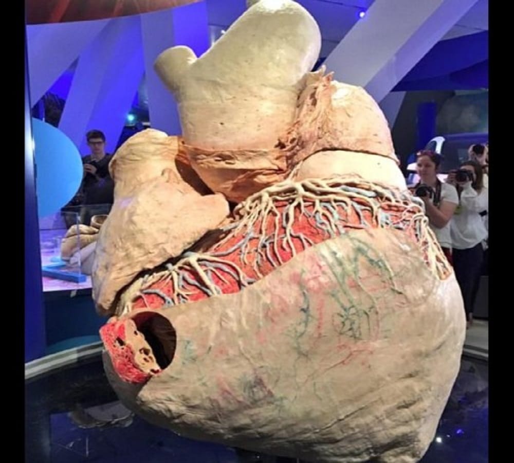 This is the worlds heaviest heart weight is 262 kg