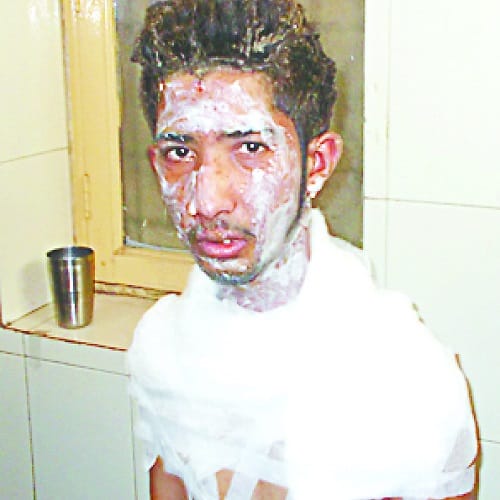 Cylinder cracked in the wedding house, will see the pictures of the injured