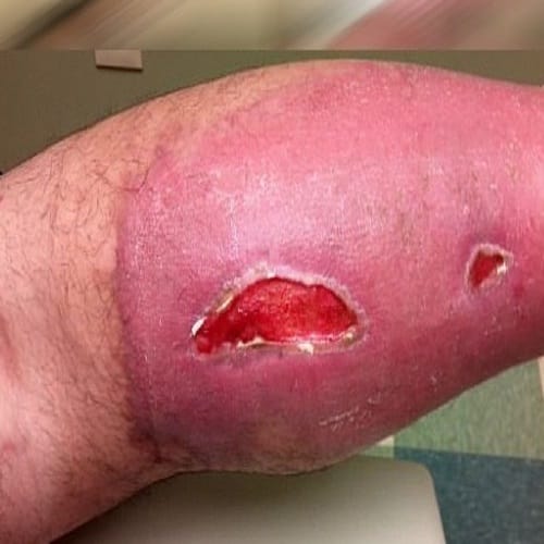 Know how dirt can make a bug to eat your flesh and left you with damaged organ