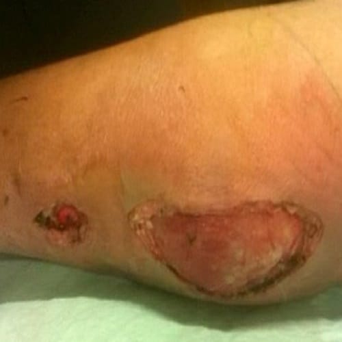 Know how dirt can make a bug to eat your flesh and left you with damaged organ