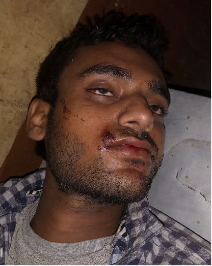 Youth dies in road accident in sitarganj