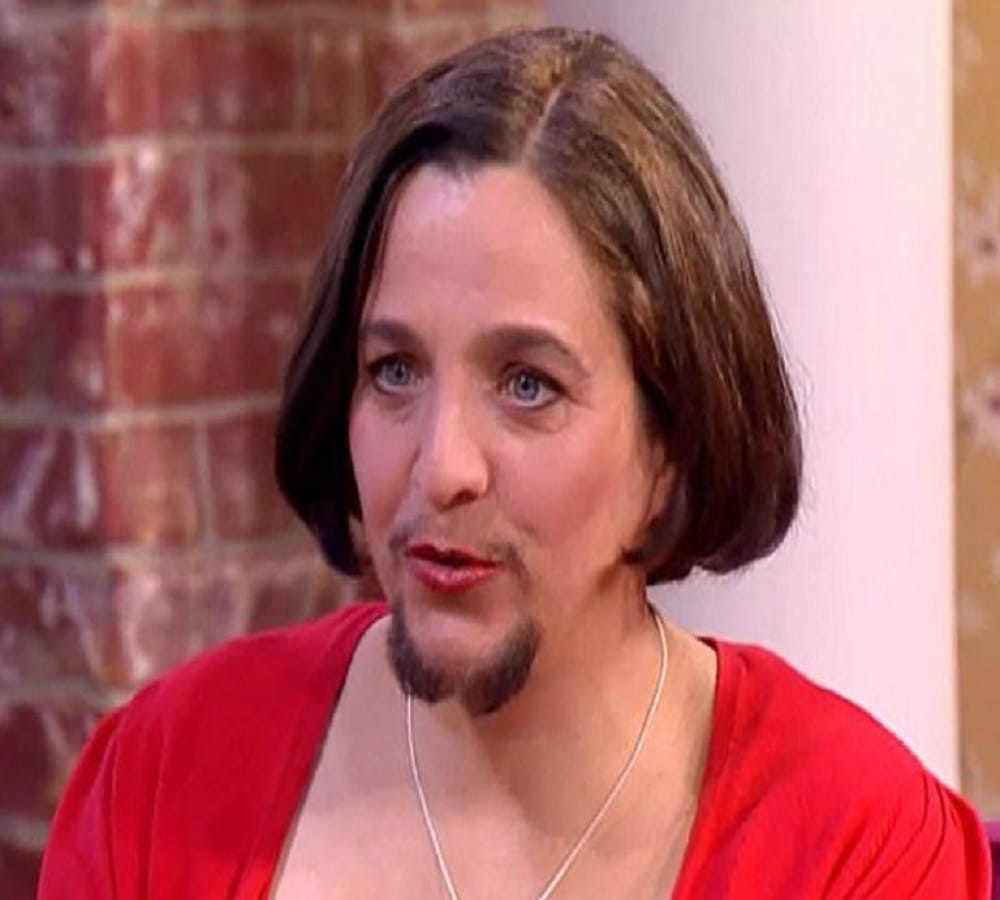 women with beard looks like an celebrity