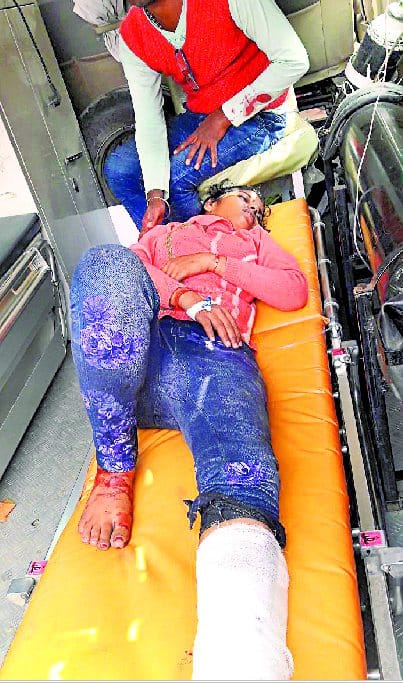 In the grip of train, cut off student's legs