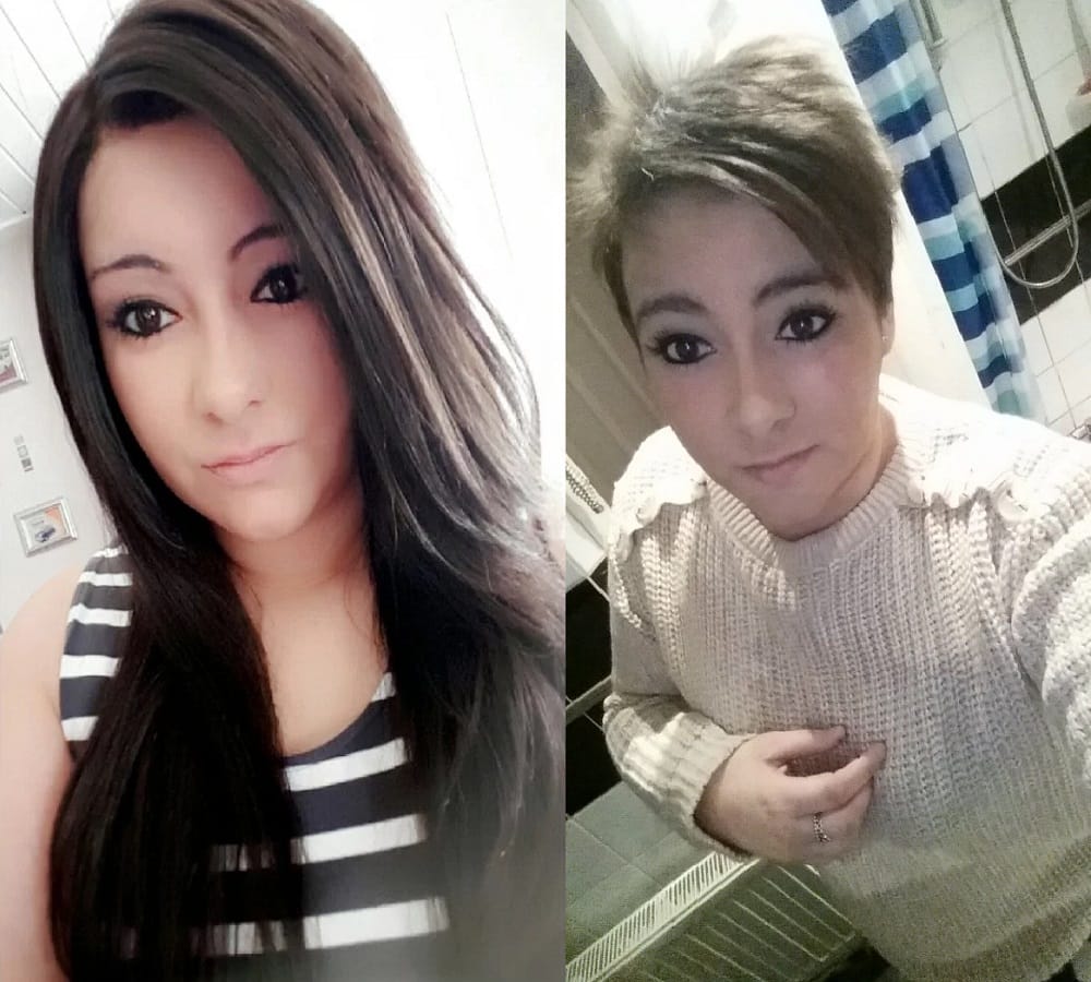 Woman claims her old relationship gave her Baldness