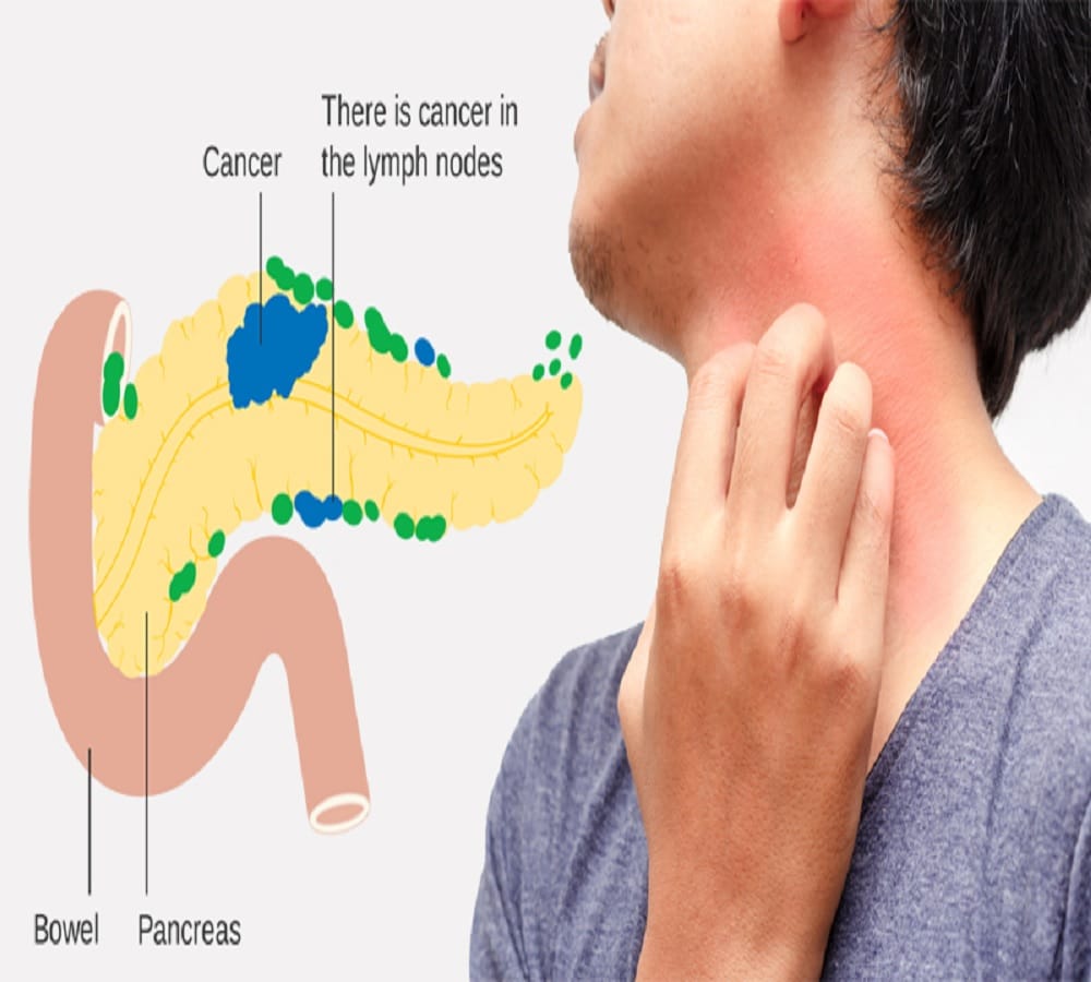 This Is How Pancreas Help In Food Digestion