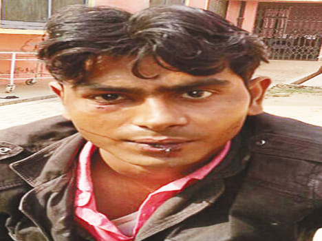 Two bikes collide, one youth died, three injured