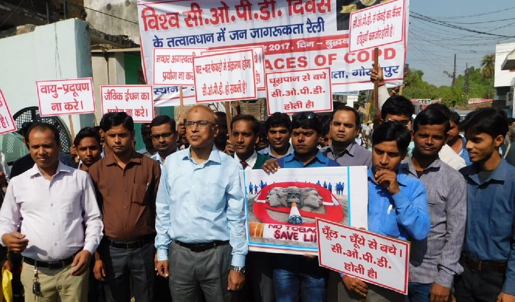 सीओपीडी दिवस पर 150 मरीजों की जांच हुई