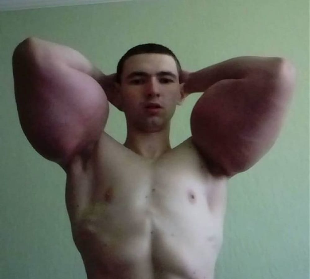 Former Soldier looks like cartoon character popeye