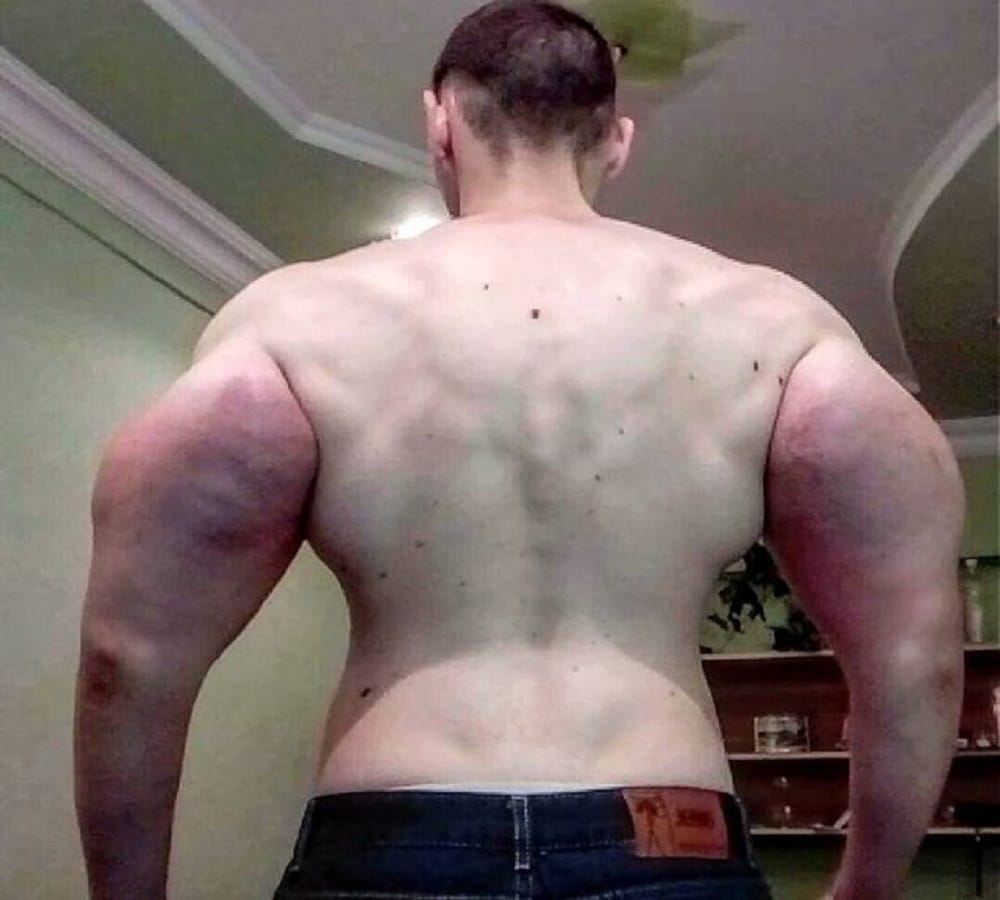 Former Soldier looks like cartoon character popeye