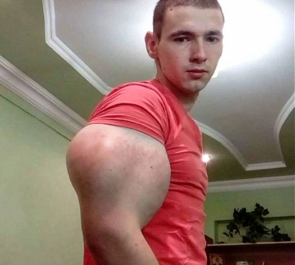 Former Soldier looks like cartoon character popeye