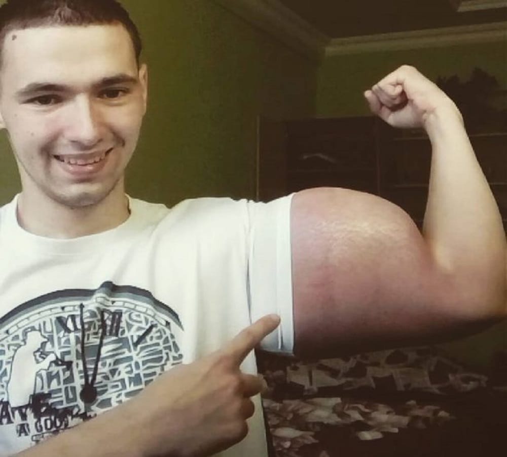 Former Soldier looks like cartoon character popeye