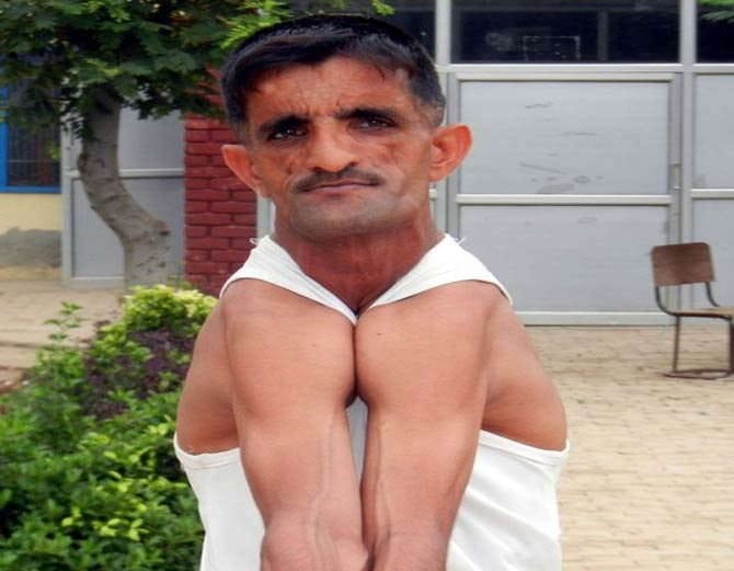 weird stories, unique people, indian rubber man rammehar punia bizarre record in guinness book