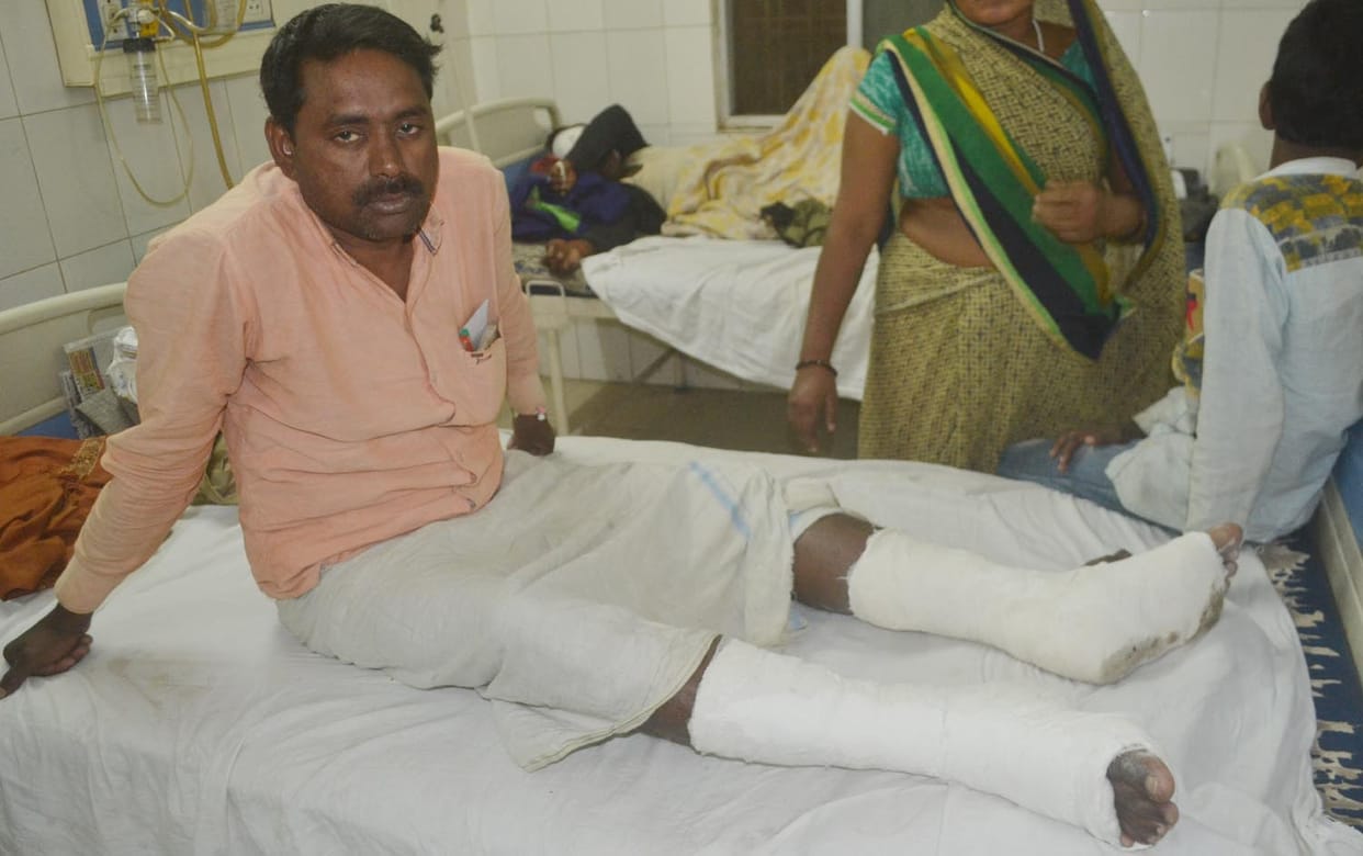 a man both leg break after daroga trying to beat him