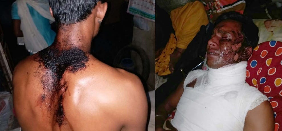 acid attack on haroon while he was going to meet his ill son