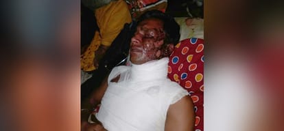 acid attack on haroon while he was going to meet his ill son