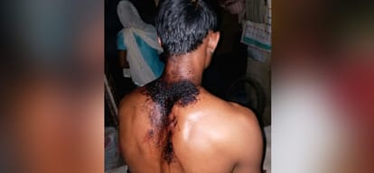 acid attack on haroon while he was going to meet his ill son