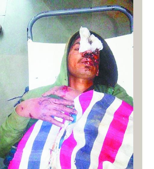 बेरहमी से पीटकर सड़क पर फेंका युवक