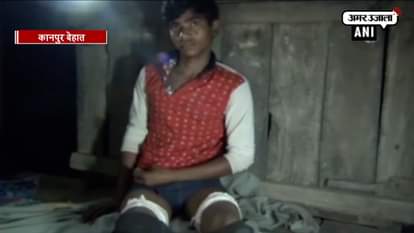 STUDENT SUFFERS CUTS AFTER SCHOOL ADMINISTRATION CHOPS OFF HIS JEANS KANPUR DEHAT UTTAR PRADESH