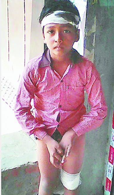 स्कूल में क्लास तीन के छात्र को बेरहमी से पीटा