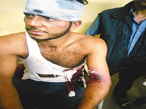 Firing in ground rage, youth injured by bullet 