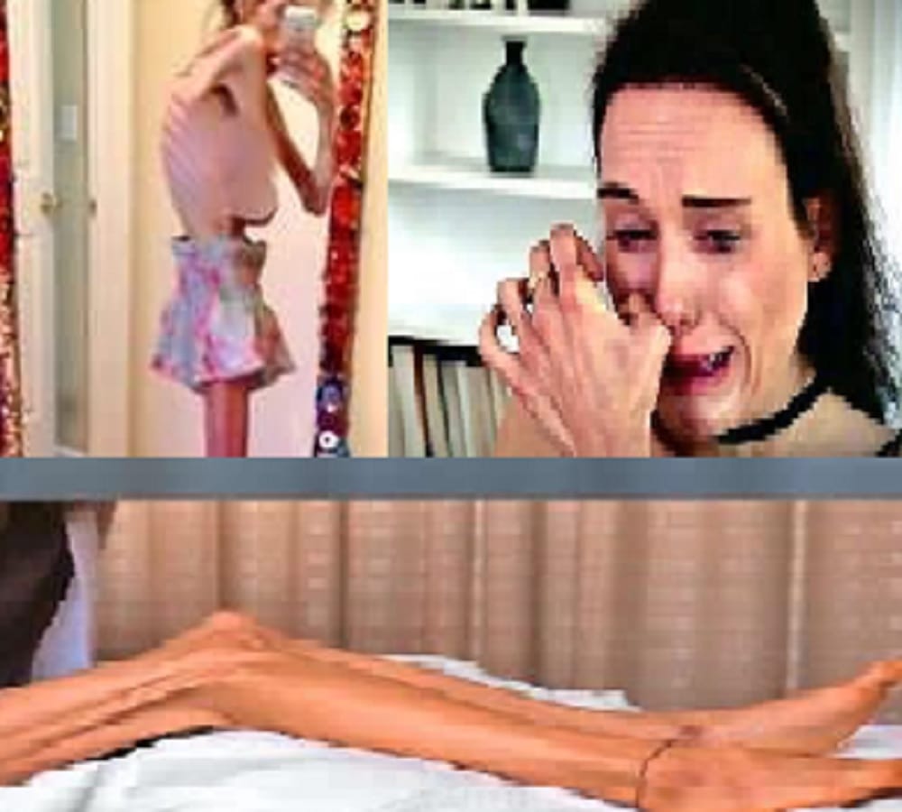 new york skinny girl Dieting from 16 years