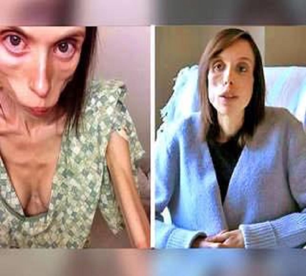 new york skinny girl Dieting from 16 years