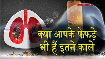smoking cause many type of diseases special story