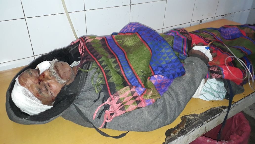 A memu train hits a vehicle in amethi.