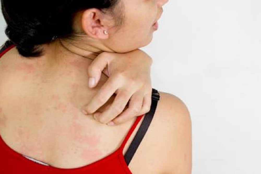 causes of skin dullness and dryness