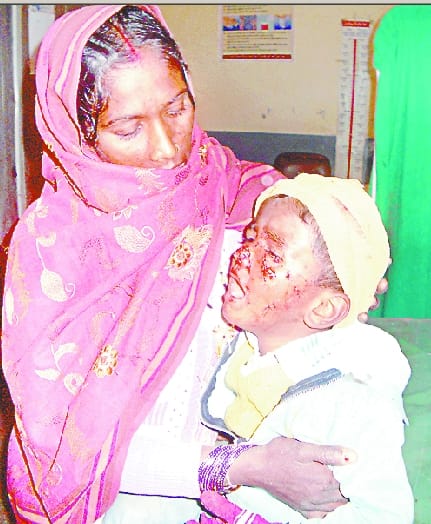 The children playing outside the house were taken by stray dogs