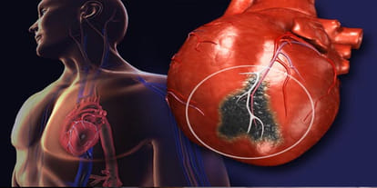 Due to cold rising heart attack three died
