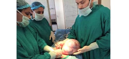 Himachal Mandi 6 kg tumour removed from woman stomach