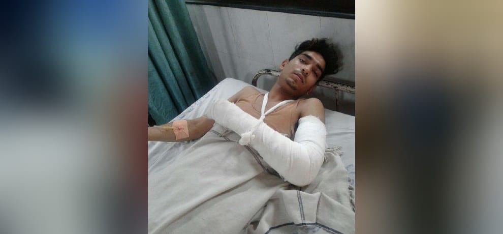 twelveth  class student beaten by a rod due to which his hand'd bone got broken