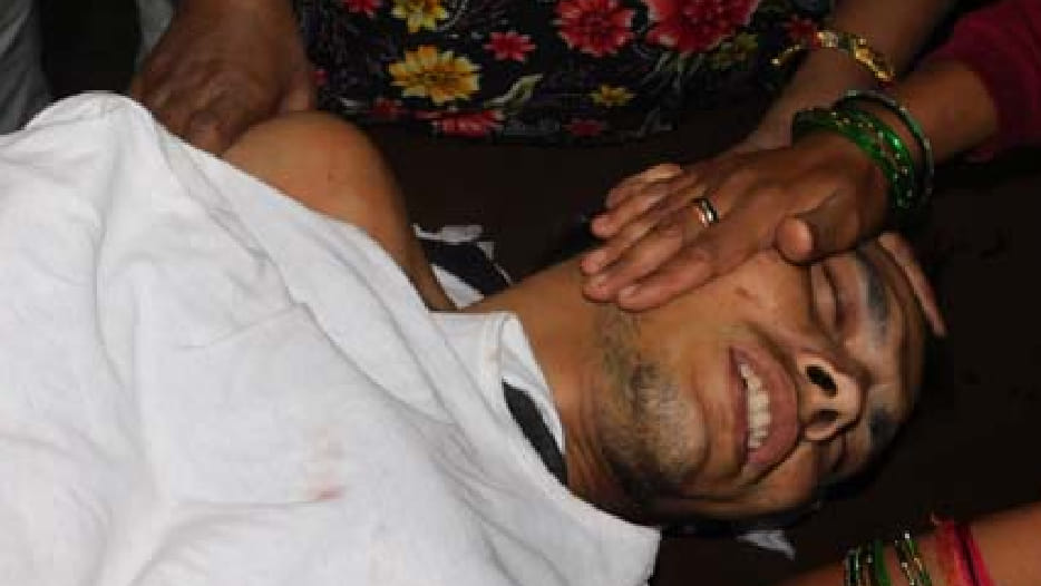 BJP and SP supporters many injured in assault and firing