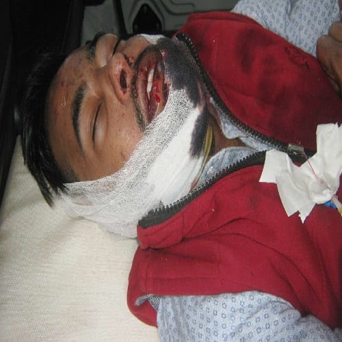 The car crashed the bike rider couple death photos