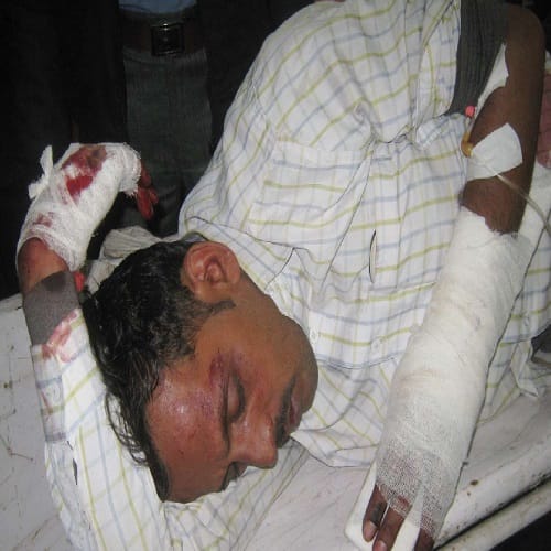 The car crashed the bike rider couple death photos