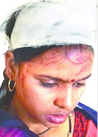 एक भाई की जमीन खरीदी, दूसरे के बच्चों ने सिर फोड़ा