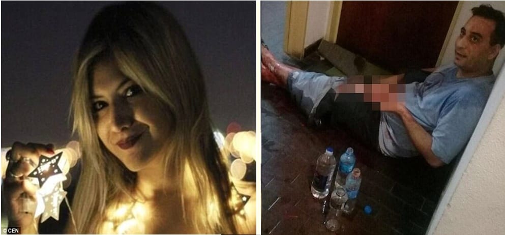 Woman cut off boyfriends genitals with garden shears in Argentina