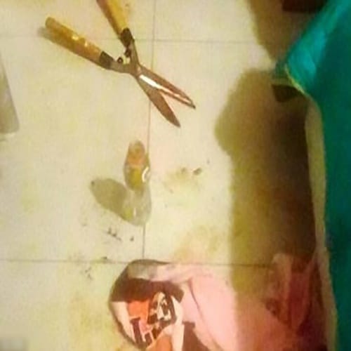 Woman cut off boyfriends genitals with garden shears in Argentina