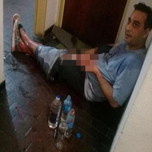 Woman cut off boyfriends genitals with garden shears in Argentina
