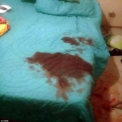 Woman cut off boyfriends genitals with garden shears in Argentina