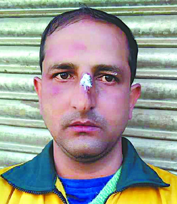 40 thousand cash and mobile phone attacker