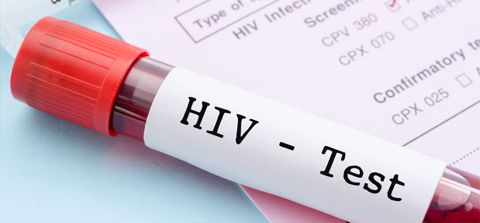 three people of family were HIV positive